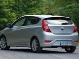 Hyundai Accent 2013 годаfor4 700 000 тг. в Костанай – фото 2